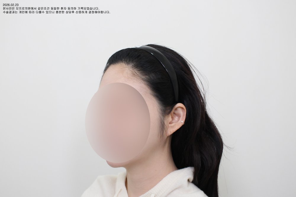 施術後の症例写真