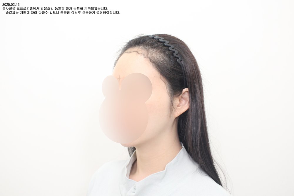施術前の症例写真